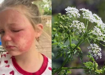 Menina de 6 anos é envenenada por planta do jardim e mãe faz alerta: ‘estava se espalhando rapidamente’ 8