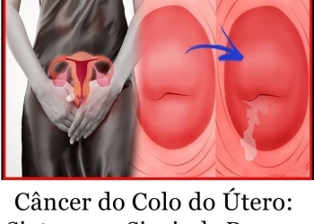 Sintomas do câncer de colo de útero que não podem ser ignorados 4