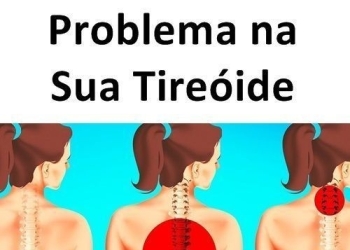 Sinais que podem indicar problemas na tireoide 3